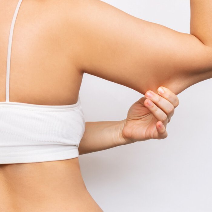 Femme avec peau relachee