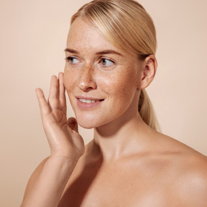 Pigment spots: close-up of a woman's face